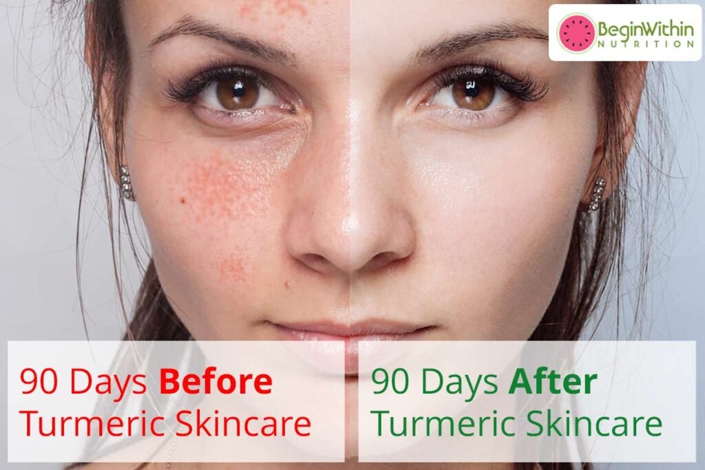 Benefits of Turmeric for Skin